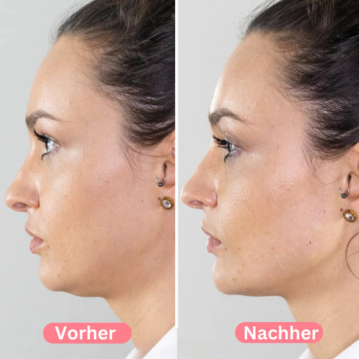 ViaLift massagegerät
