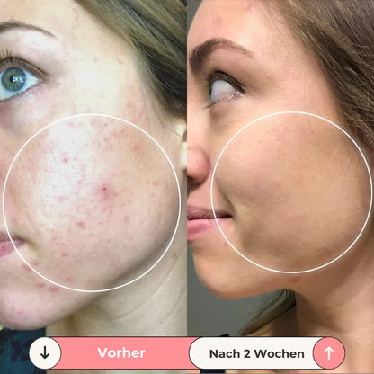 DermaGlow Frequenz Stab