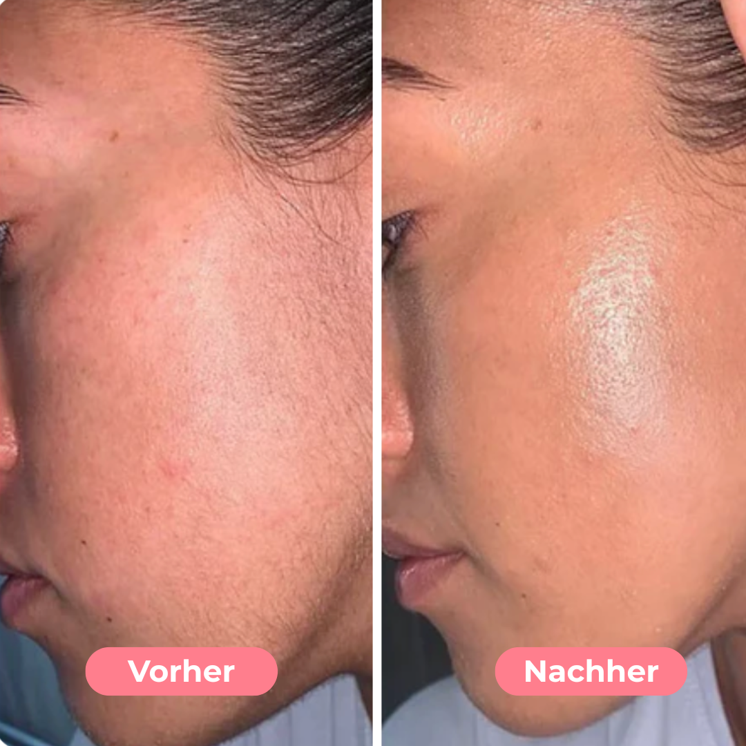 LumiTrim Für glatte, strahlende Haut in Sekunden